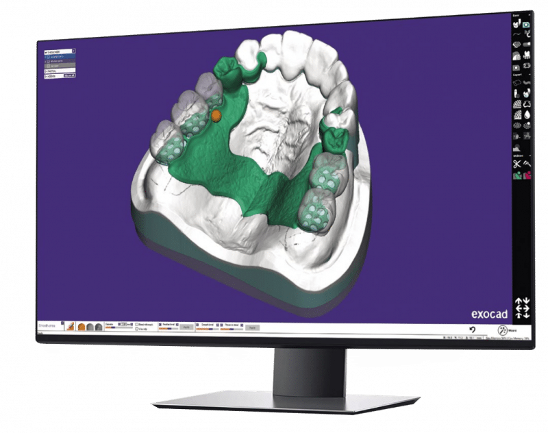 - exocad Ultimate Lab Bundle - Flex/Perpetual license - Bristol CadCam