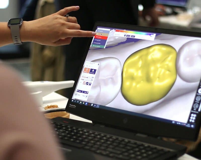 Software - CAD/CAM dental software - Bristol CadCam